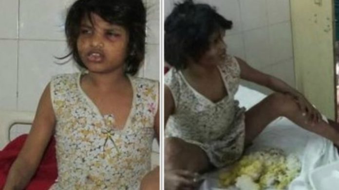 Bambina allevata dalle scimmie in India Bambina allevata dalle Scimmie: trovata in India