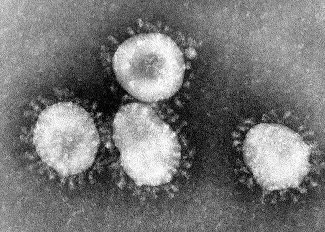 coronavirus sars