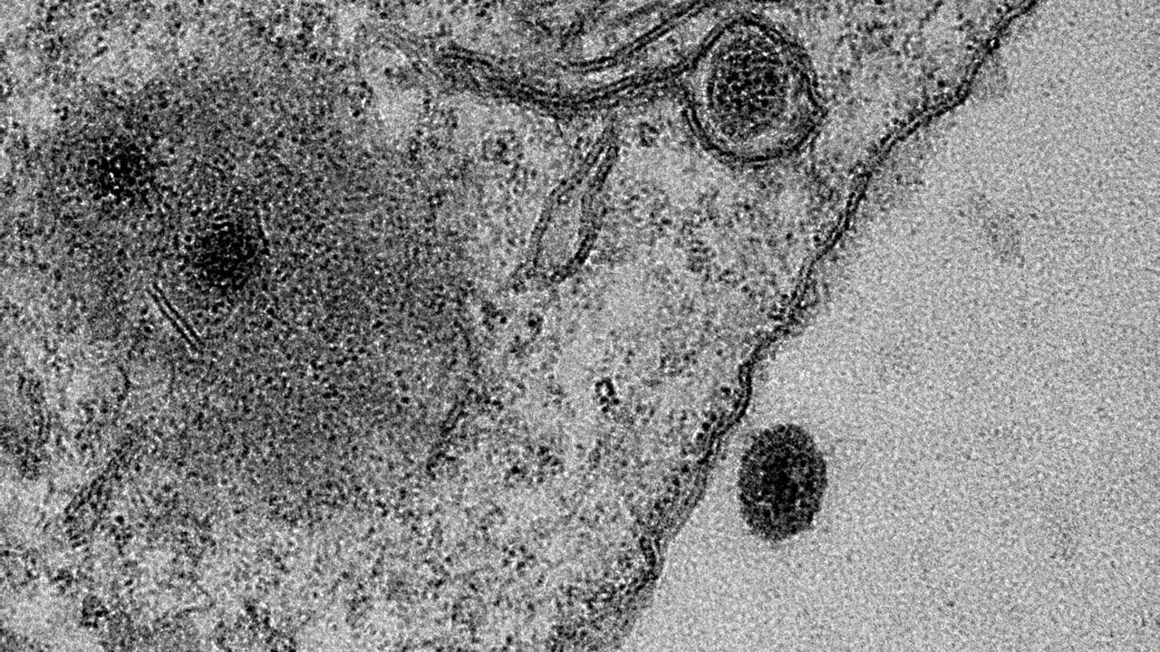 Photo of Cos’è lo Yaravirus scoperto in Brasile? Origini del nome e Caratteristiche